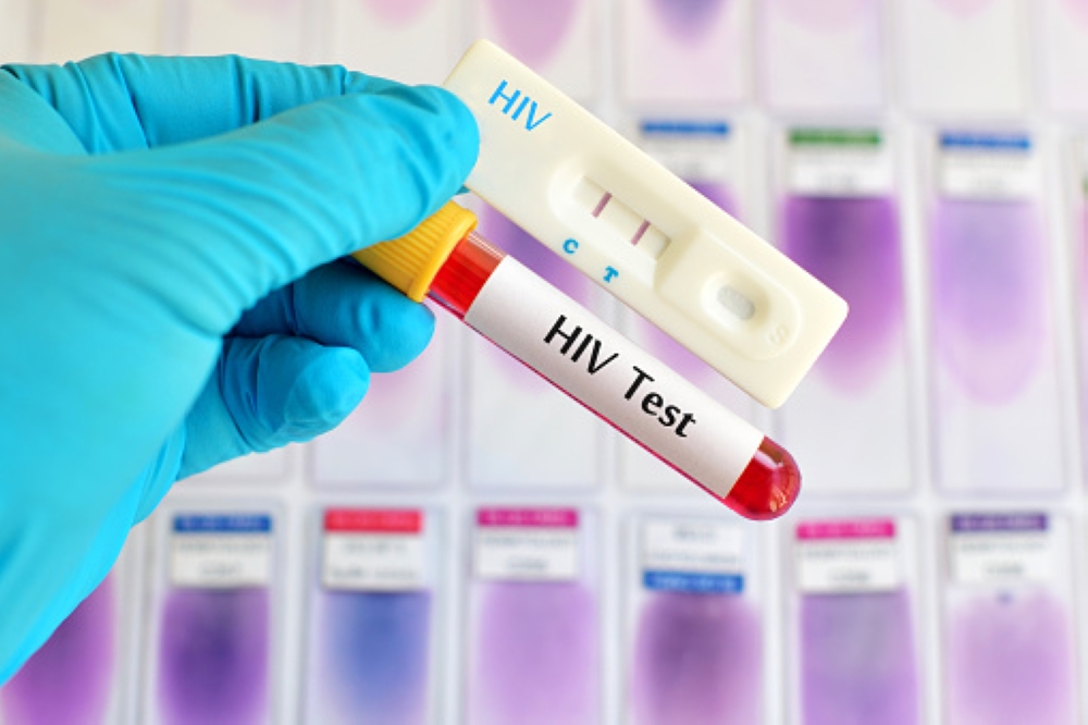 RBC&#039;s division promotes HIV testing services across various platforms, including community outreach and the distribution of HIV self-test kits.