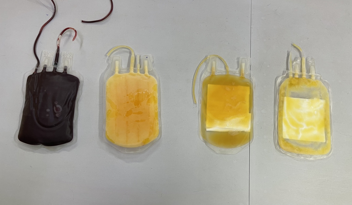 Various blood components in dedicated bags from left to right: red blood cells, plasma, platelets, and cryoprecipitates, at RBC’s Blood Transfusion Division in Kigali, on July 30, 2024. Rwanda plans to sell plasma surplus to address production cost and ease access to derived lifesaving medication.