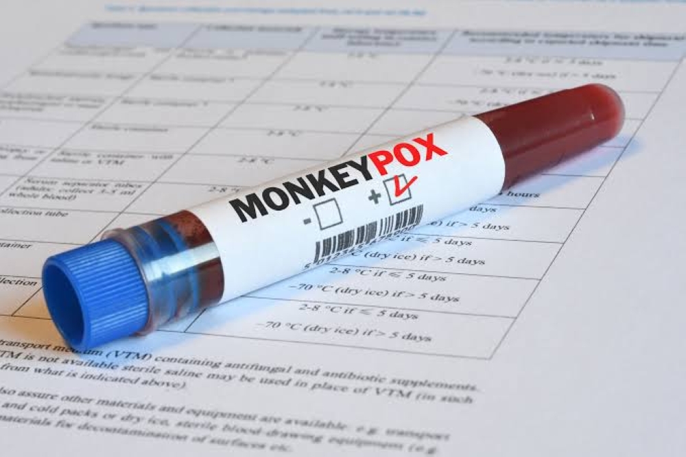 Mpox – an infectious disease caused by the monkeypox virus.