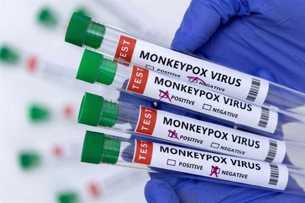 Mpox, a viral illness caused by the monkeypox virus.