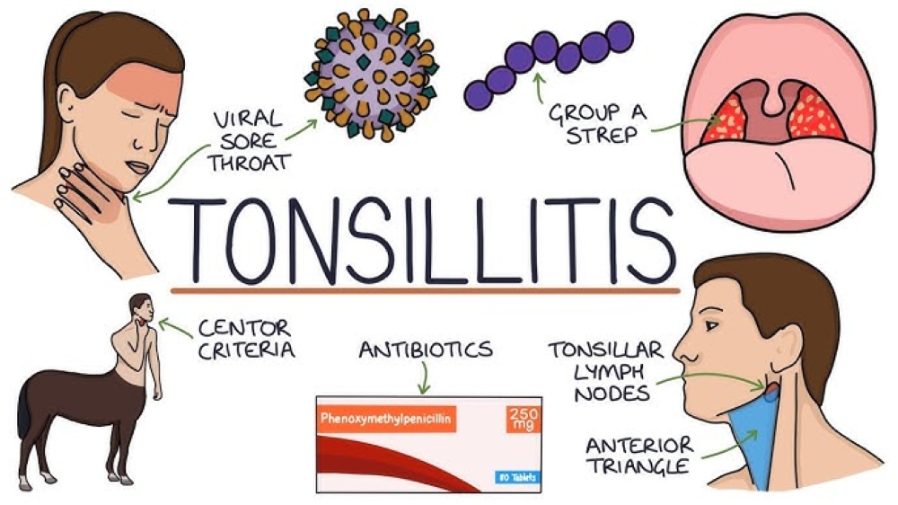 Tonsillitis is primarily caused by bacterial or viral infections, resulting in painful and swollen tonsils, high fever, nasal congestion, cough, and possibly difficulty breathing.