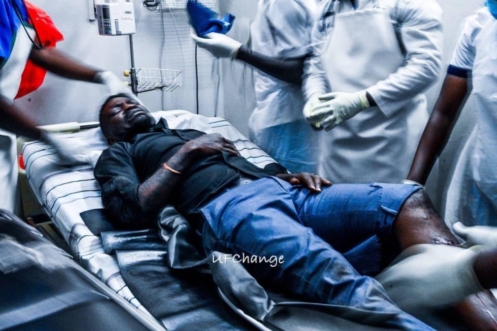 Robert Kyagulanyi, popularly known as Bobi Wine, is recovering after sustaining an injury in a violent confrontation with security officers.