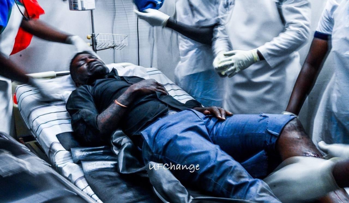 Robert Kyagulanyi, popularly known as Bobi Wine, is recovering after sustaining an injury in a violent confrontation with security officers.