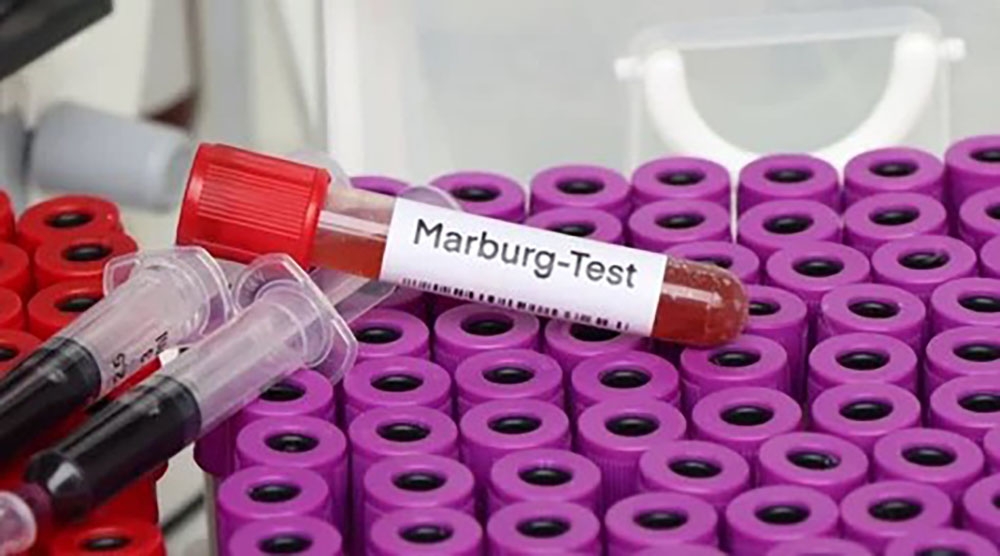 The Marburg virus originated from the German city of Marburg in 1967