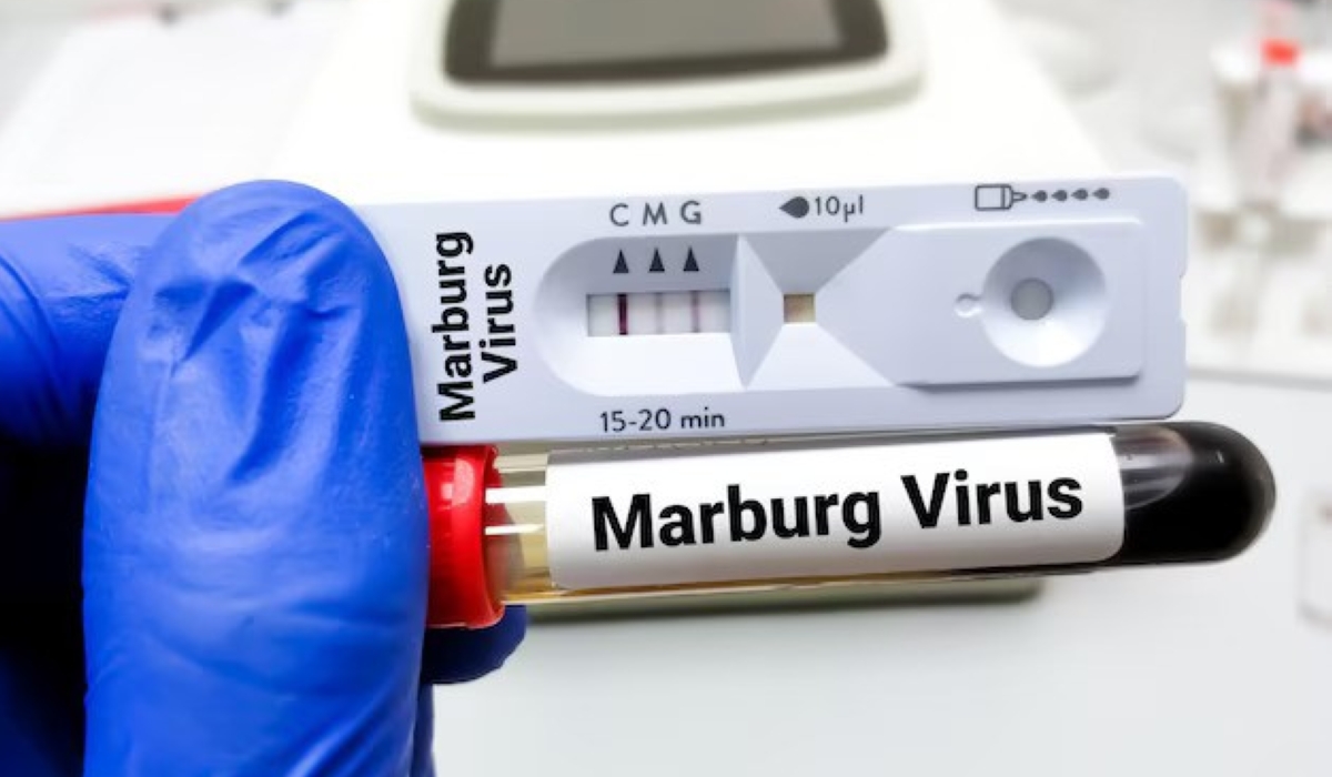 The death toll from the Marburg virus increased to 11 after one person dies from the disease on Wednesday, October 2. Courtesy.