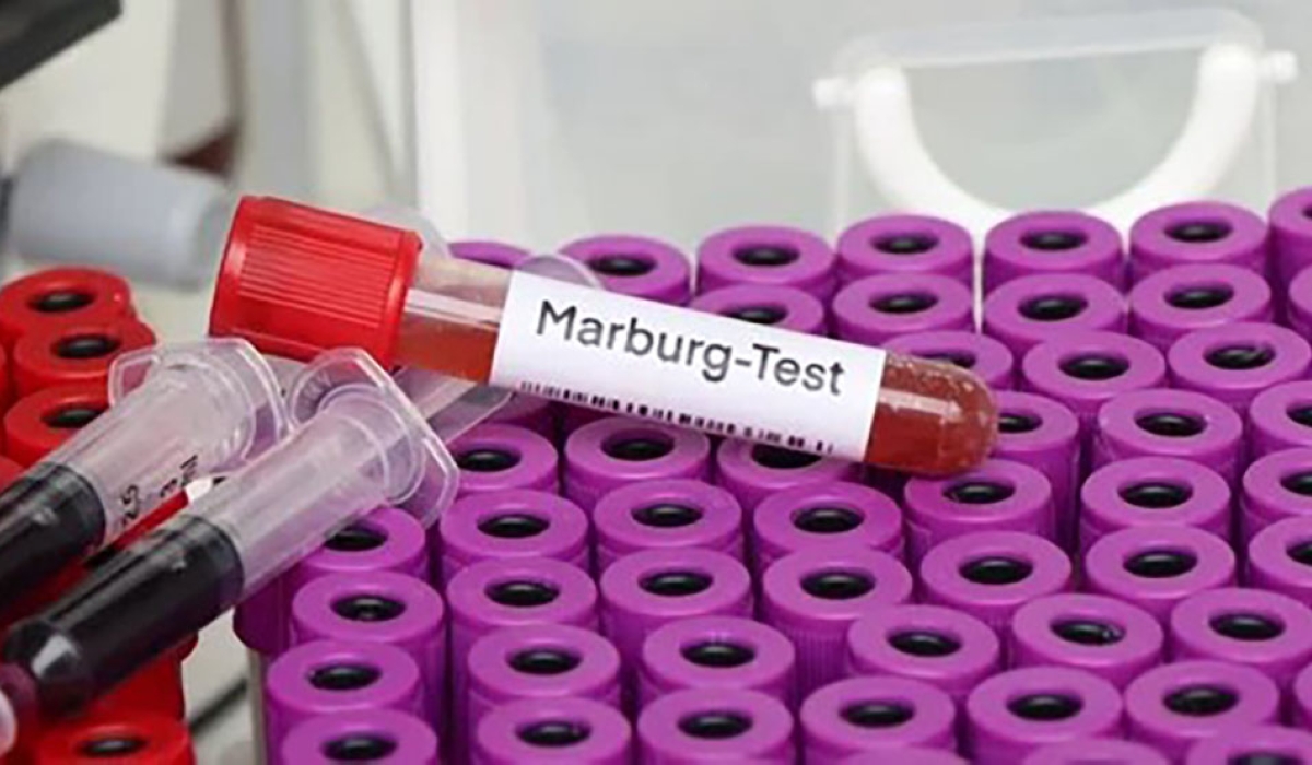 The Marburg virus originated from the German city of Marburg in 1967