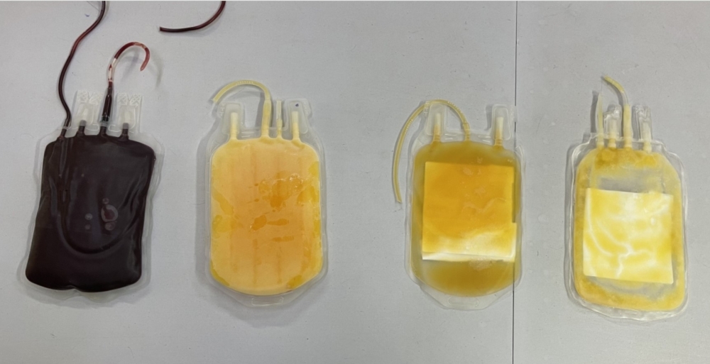 Various blood components in dedicated bags from left to right red blood cells, plasma, platelets, and cryoprecipitates, at RBC’s Blood Transfusion Division in Kigali, on July 30, 2024.