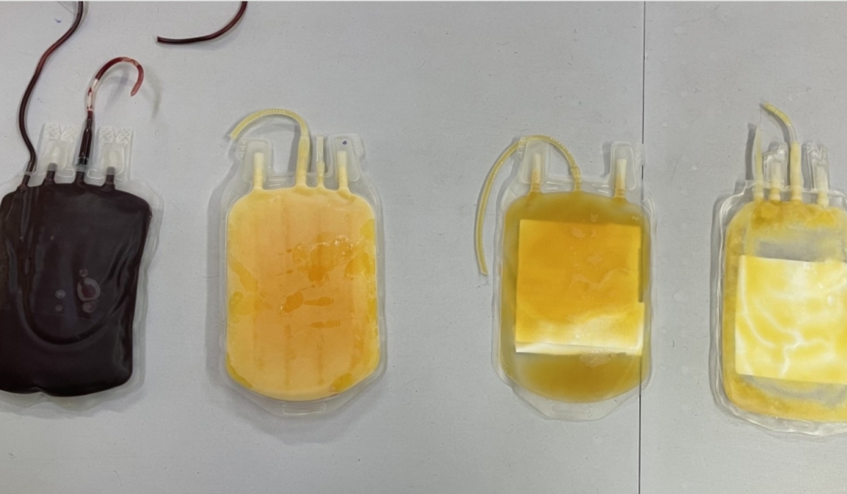 Various blood components in dedicated bags from left to right red blood cells, plasma, platelets, and cryoprecipitates, at RBC’s Blood Transfusion Division in Kigali, on July 30, 2024.