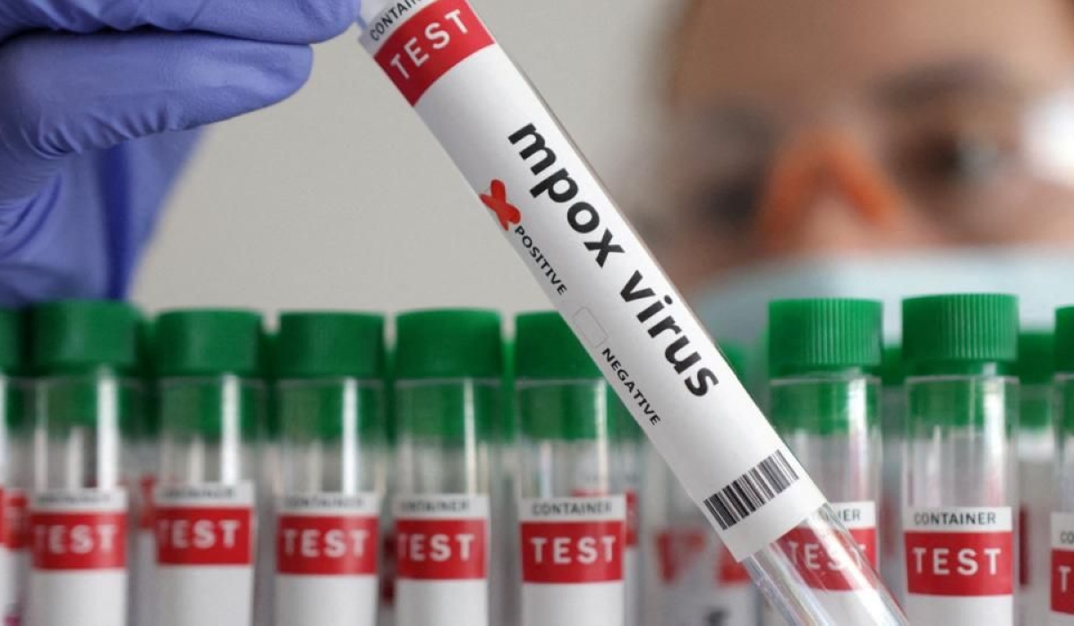 The epidemiological situation of Mpox in Africa remains especially concerning, with high case counts observed in DR Congo, Burundi, and Uganda.