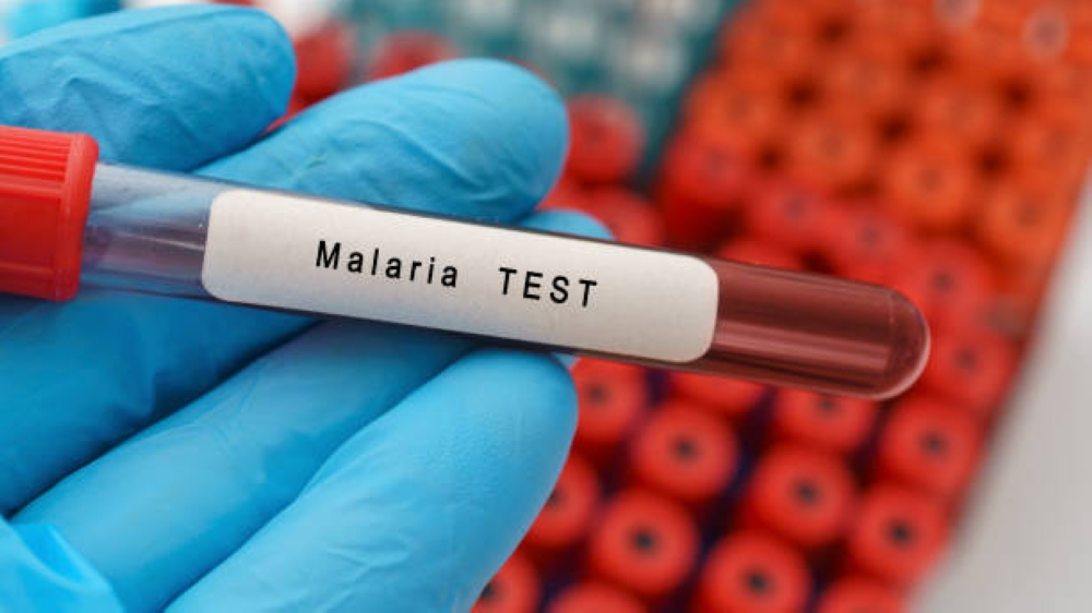 Malaria blood test, conceptual image