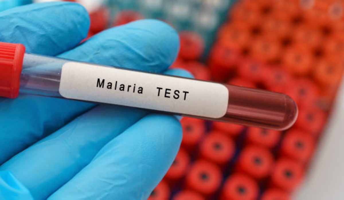 Malaria blood test, conceptual image