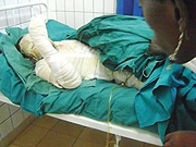 AGONY: Juvenal Sinayobye University Hospital Centre where he is being treated. (Photo/ G.Mugoya)