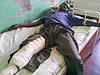 Corporal Mbanzabugabo, a rebel of FDLR while lying on a bed.