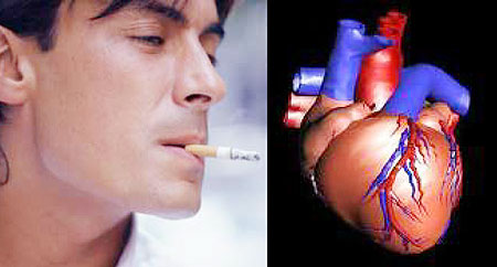 L-R : Smoking is implicated in causing coronary heart disease (Internet Photo) ; Long standing heart disease leads to reduced blood supply and affects the functioning of internal body organs(Internet Photo)