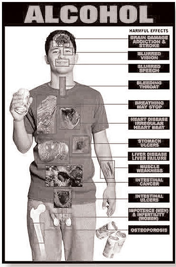 Used frequently,alcohol tends to cause ulceration and inflammation of the tongue /Internet Photo