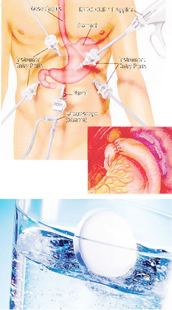 Some headache or heartburn medicines can contain sodium carbonate or bicarbonate. Net photo