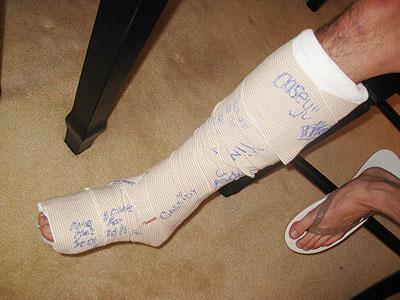 The Achilles heel is suspceptible to injuries . Net photo.